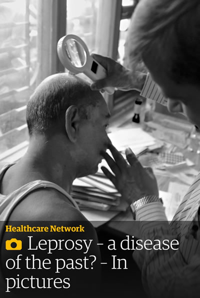 The Guardian - Leprosy – a disease of the past